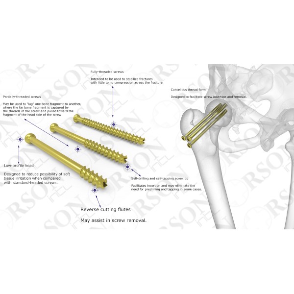 Cannulated Screw System Cannulated Screw System